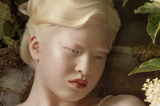 Фотографии девушек альбиносов (60 фото) 🌟